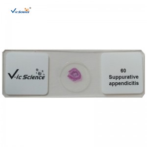 Setul de 100pcs patologie umană alunecă diapozitive microscopice pregătite