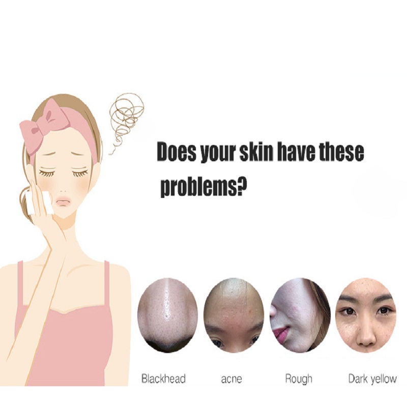 Deep Cleansing Exfoliatori Rejuvenarea pielii Liftul feței Ultrasunete Shift de piele Scruber