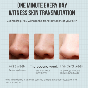 Extractor electric Extractor de îndepărtare a acneei Blackhead Remover Vacuum Beauty Machine Pore Cleaner