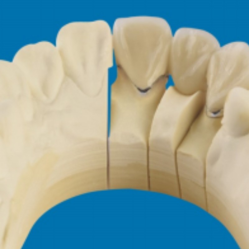 Metal-Dintii de porțelan