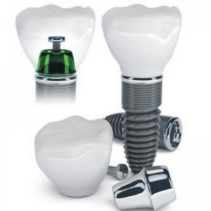 implant dentar